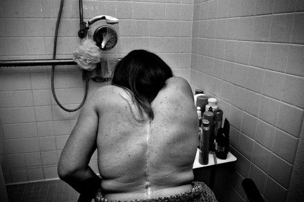 "I do love my body, but that is not an everyday feeling," says Stevens, about why she chose to allow the above photo to be taken. "So I wanted to reveal that I do have scars and they are part of me, and they're not something that I can always embrace.  For everybody — beyond disability —  shame and love are two sides of the same story, intermeshed and interwoven, and they are together for me, too."