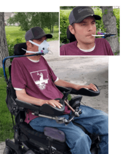 Tyler Stosich, a power chair user, came up with an effective way to route his sip-andpuff control tubing through an N95 mask. Stosich has been self-isolating with his livein girlfriend as much as possible but says he uses the mask setup “whenever I have to go to the grocery store or any public place.” He says he’ll be getting a new shipment of N95 masks soon, and he’s happy to convert and ship to anyone who needs one (email us at smcbride@unitedspinal.org).